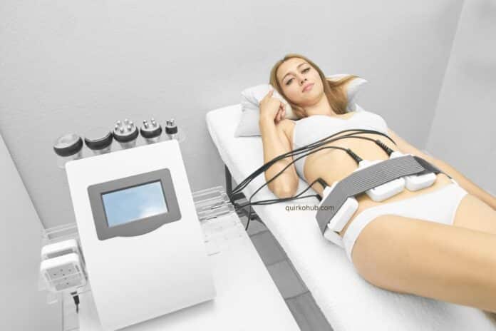 A Guide to Liposuction Recovery Time: What You Need to Know
