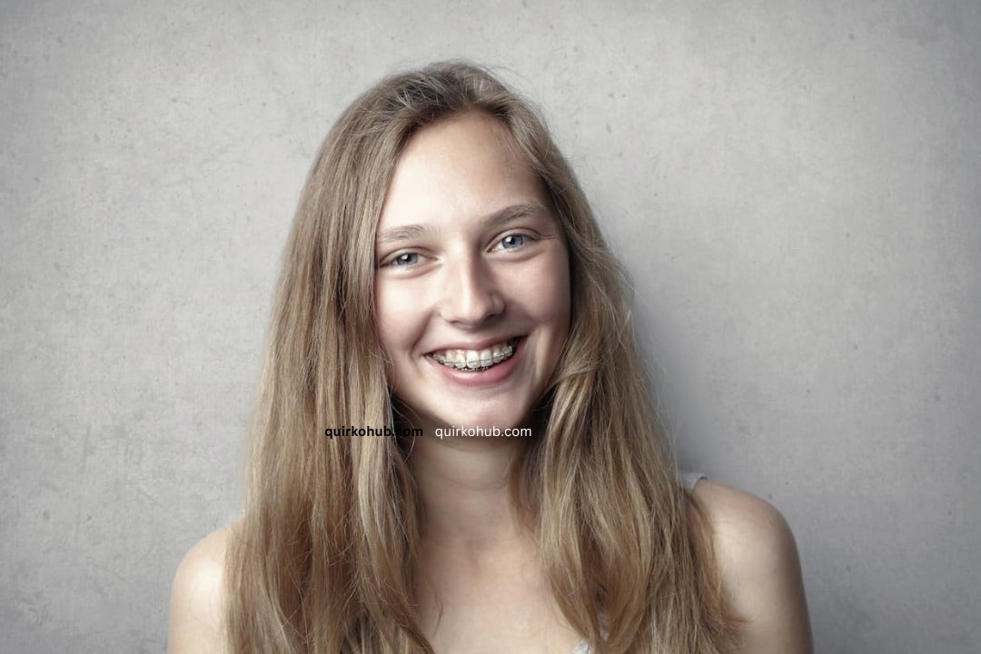 How Fastbraces Compare with Traditional Braces