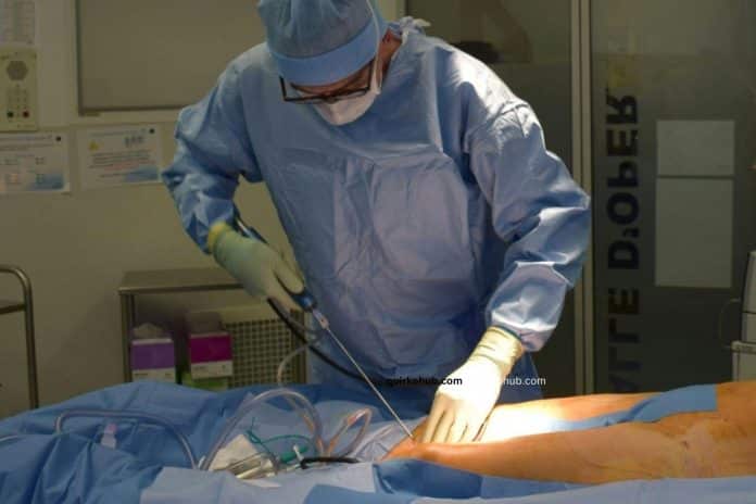 How to Choose a Skilled Liposuction Surgeon You Can Trust