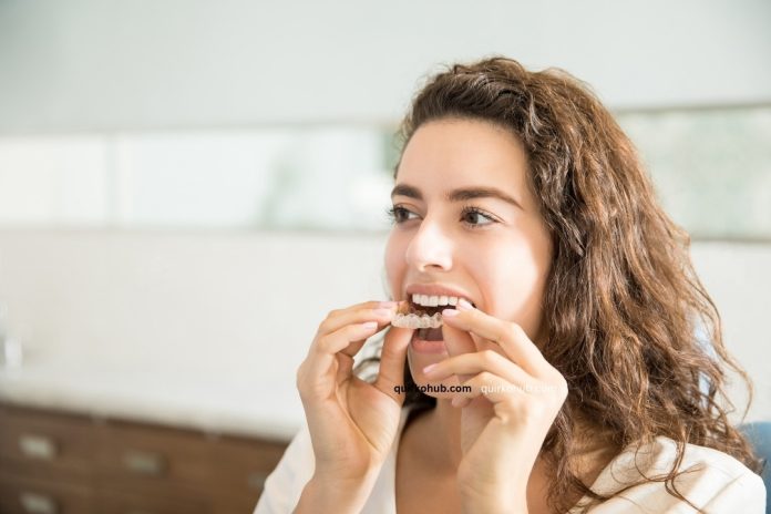 The Importance of Wearing Your Aligners as Directed